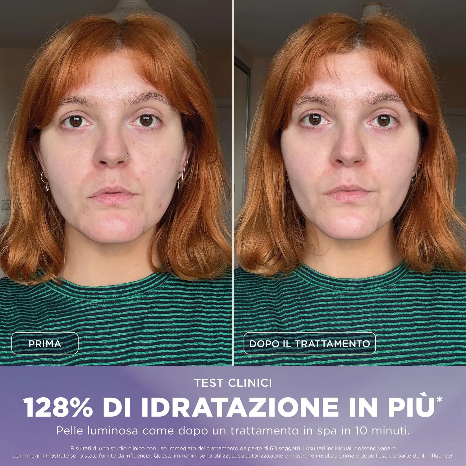 Shark FacialPro Glow FH320EU dispositivo viso nero caldo