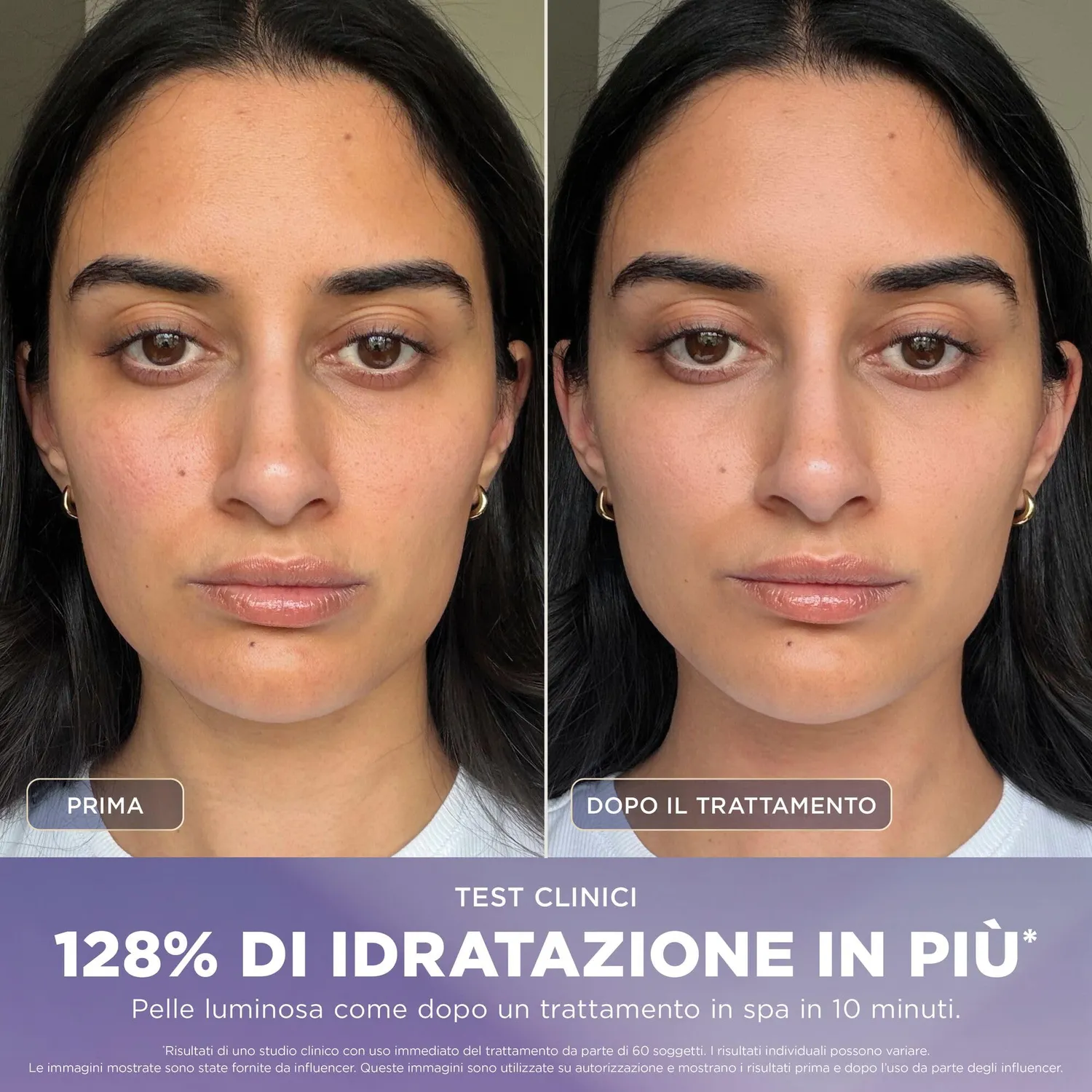 Shark FacialPro Glow FH320EU dispositivo viso nero caldo